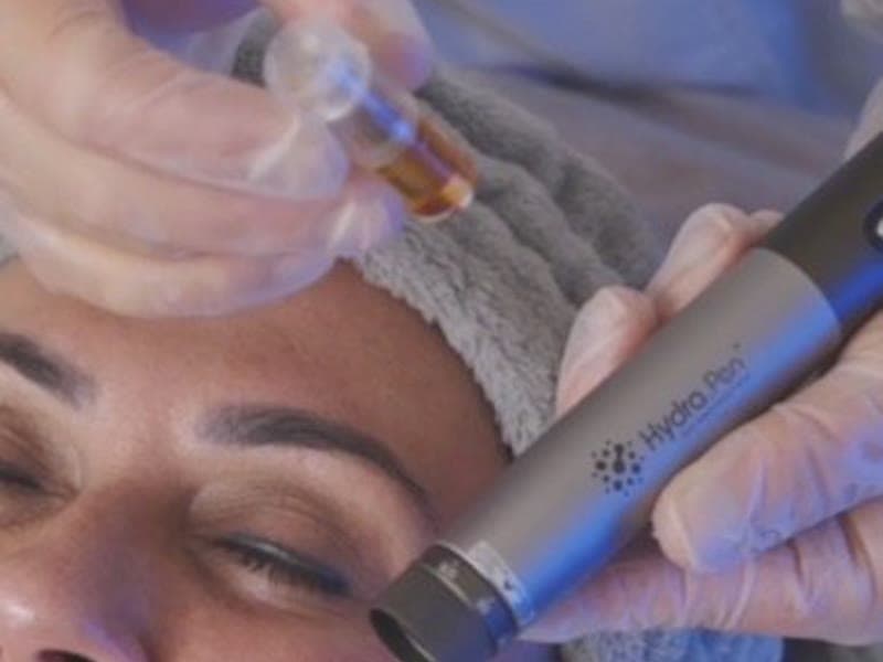 Complemento: Microneedling Convencional (Dr Pen / Hydrapen)