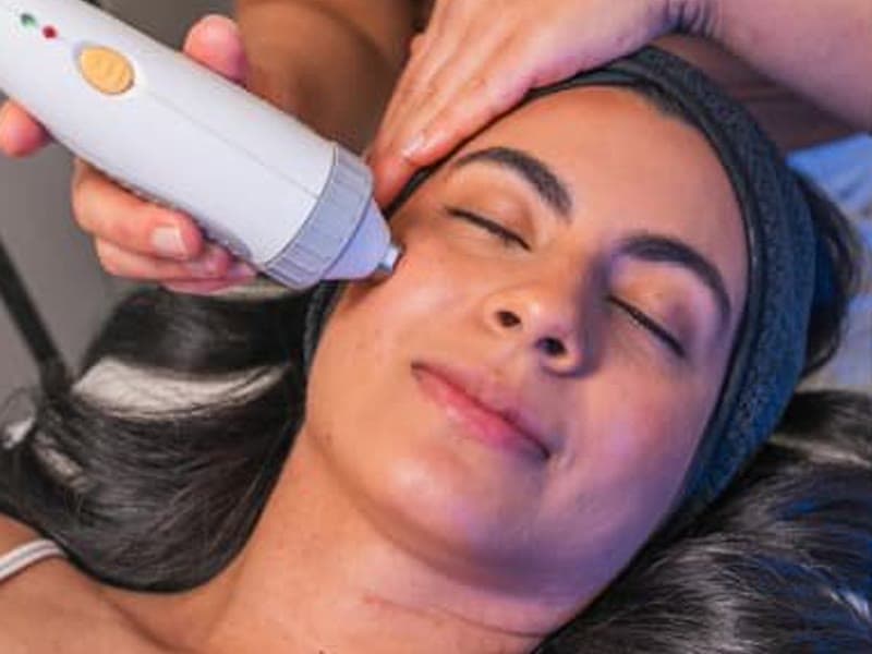 Face + Neck + Décolleté Lifting (RF)