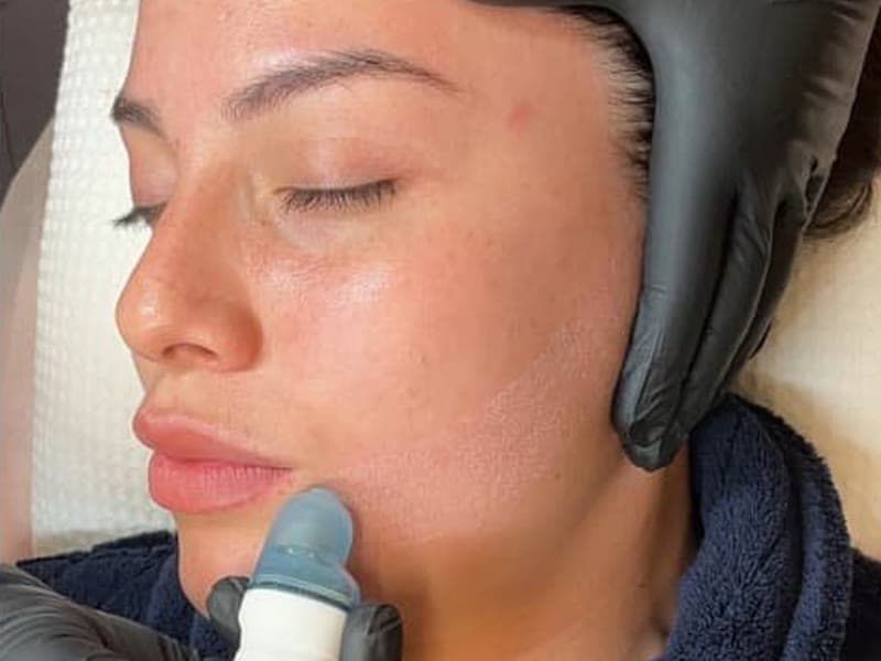 Signature Deep Cleansing