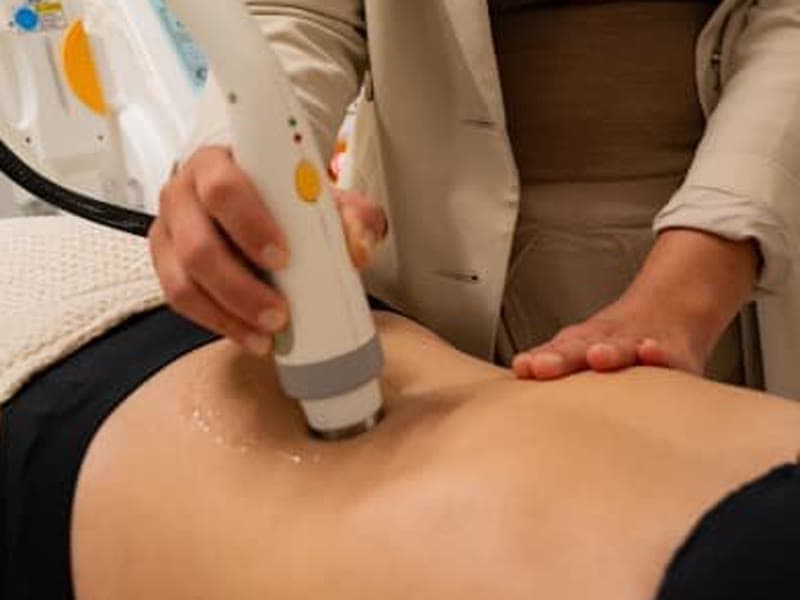 Tummy Tuck (Non-Surgical)